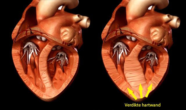 Senator voksen Demokratisk parti HCM of Hypertrofische CardioMyopathie bij de kat | Katten ziekten | Katten