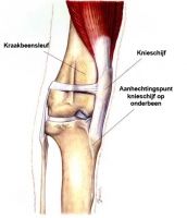 patella-luxatie.jpg