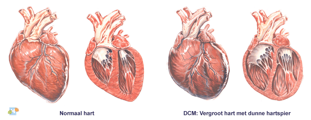 Cardiomyopathie-hond 2