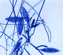 microsporum.gif